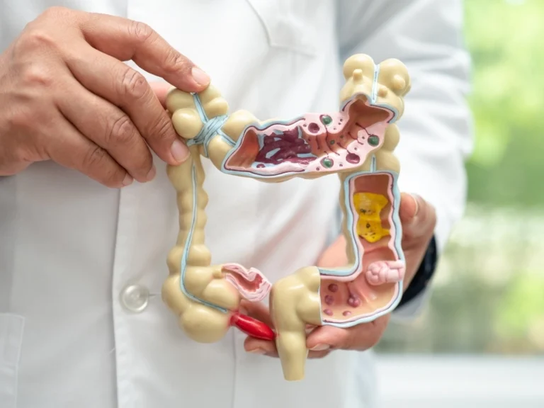Intestine, appendix and digestive system, doctor holding anatomy model for study diagnosis.